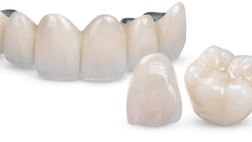 Ceramic Crowns in spain