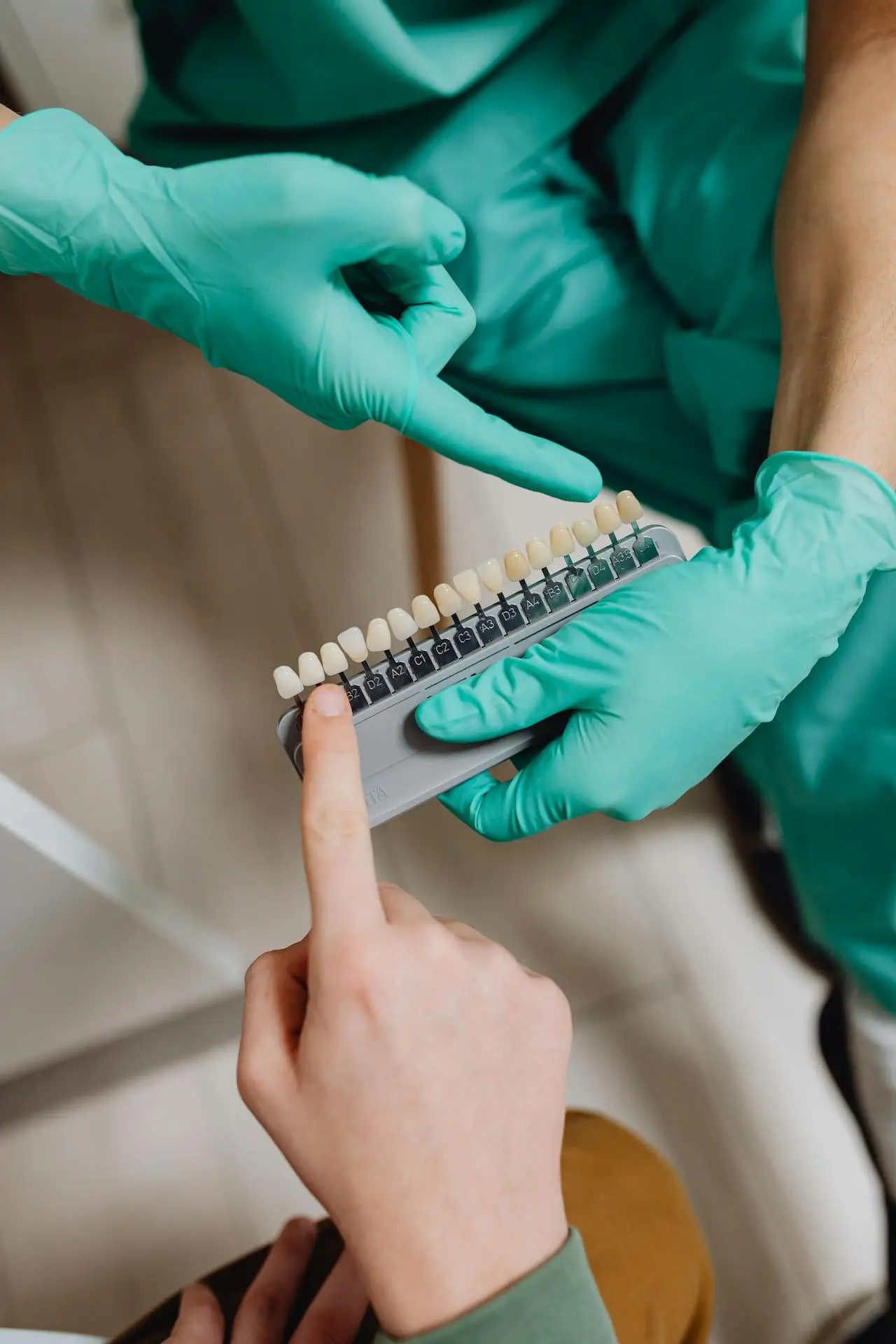 cost of Dental veneers Sapin