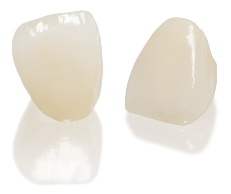 E-max Crowns in spain