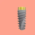 Dental implants in spain